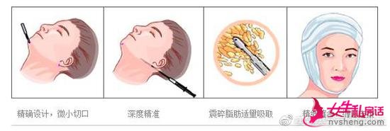沿֬