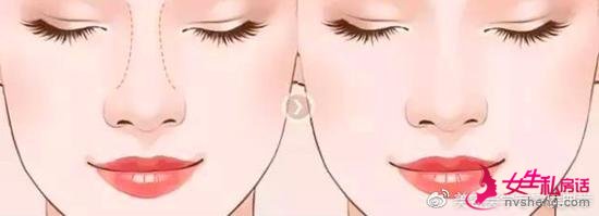 ǵĳ
